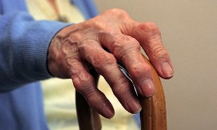 Artrite e artrosi delle dita in una persona anziana