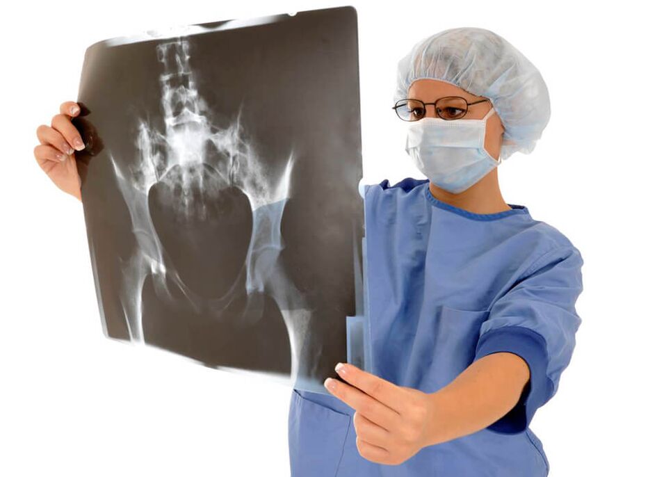 La radiografia dell'articolazione dell'anca aiuterà il medico a determinare la causa del dolore