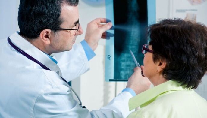 radiografia come metodo per diagnosticare l'osteocondrosi cervicale