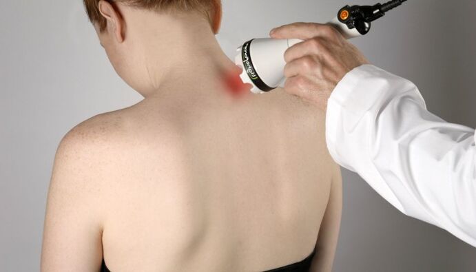 terapia laser per l'osteocondrosi cervicale
